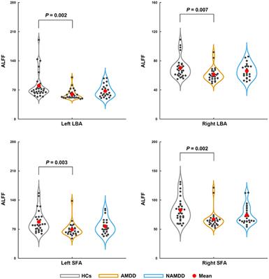 Common and Specific Alterations of Amygdala Subregions in Major Depressive Disorder With and Without Anxiety: A Combined Structural and Resting-State Functional MRI Study
